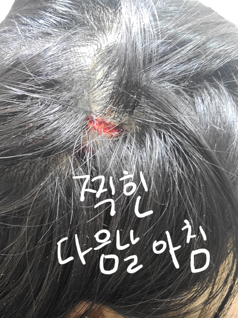 2번 째 사진