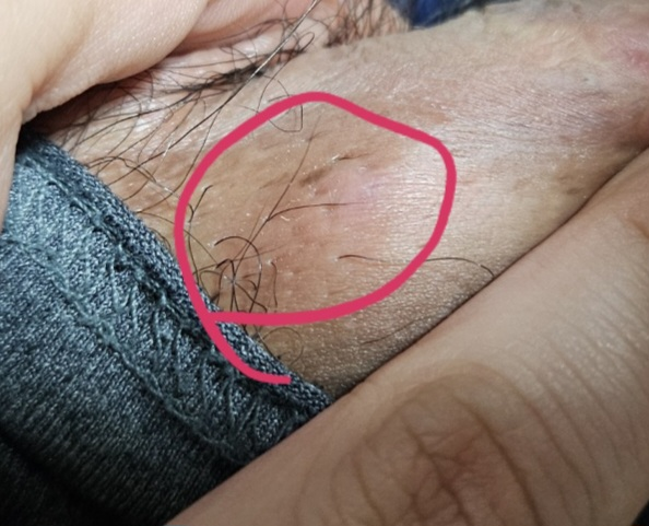 2번 째 사진