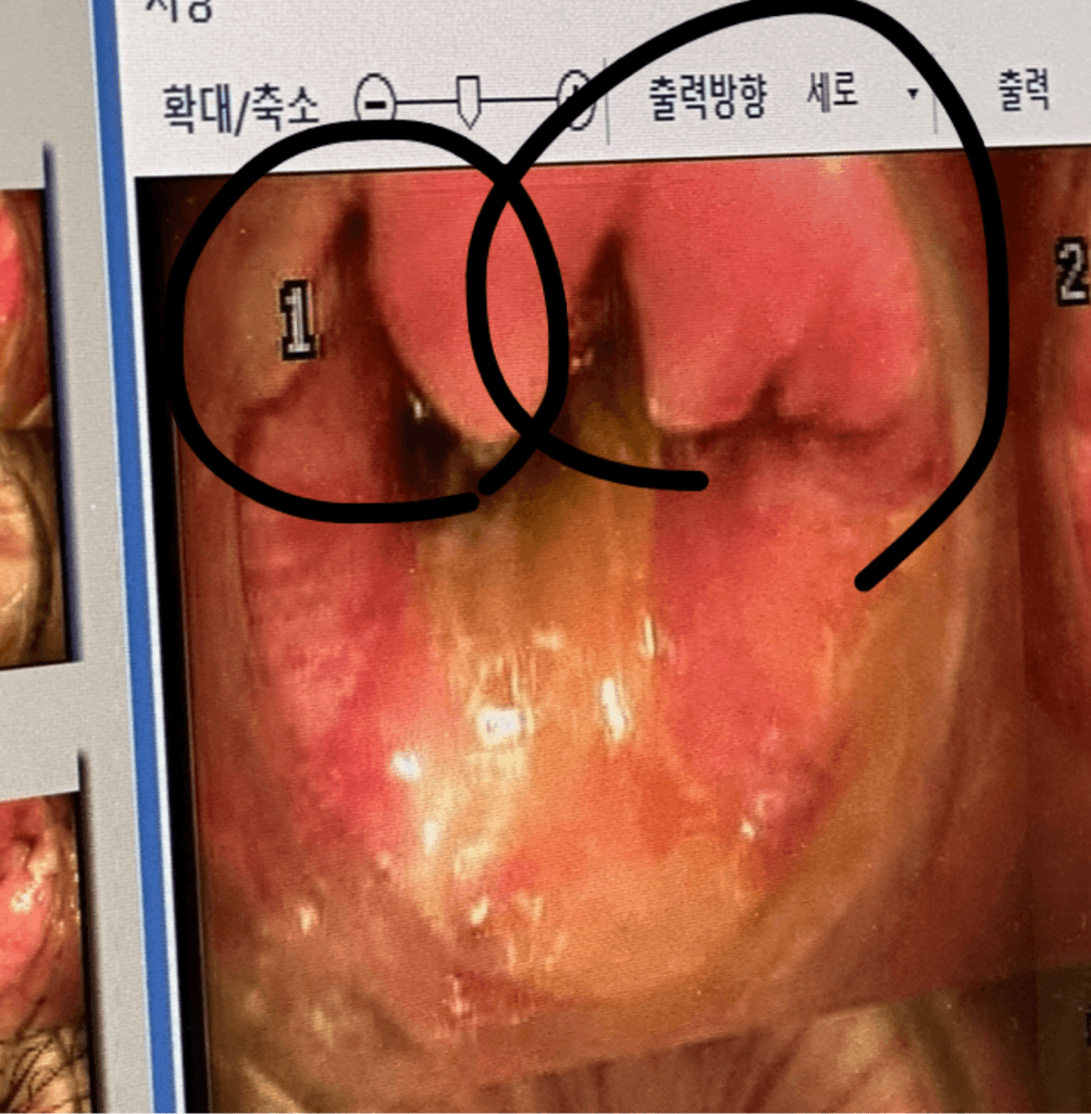 2번 째 사진