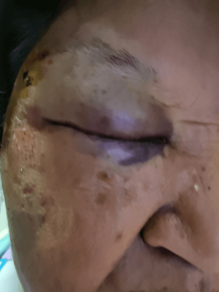 1번 째 사진