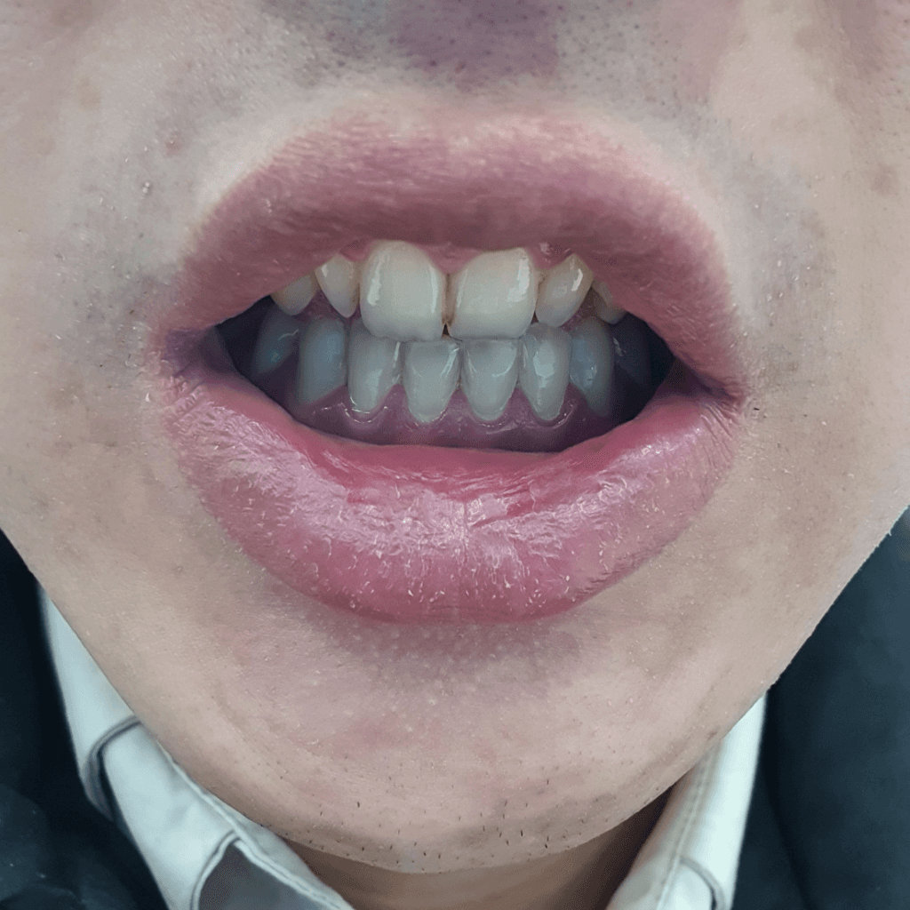 1번 째 사진