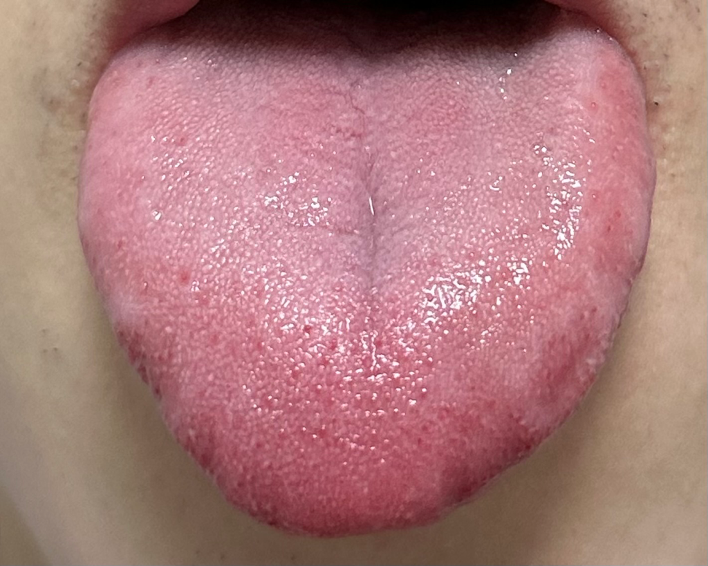 3번 째 사진
