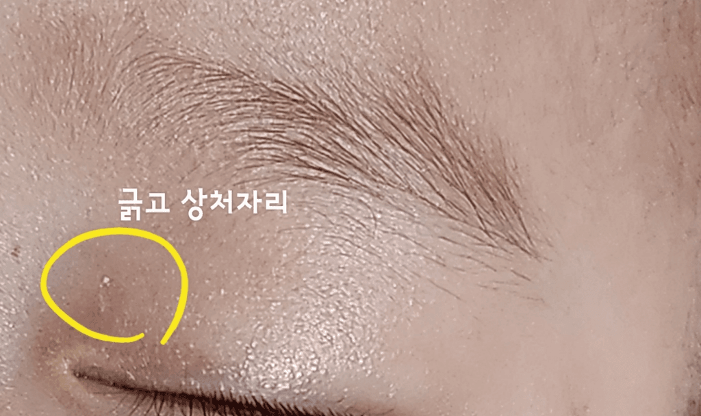 2번 째 사진