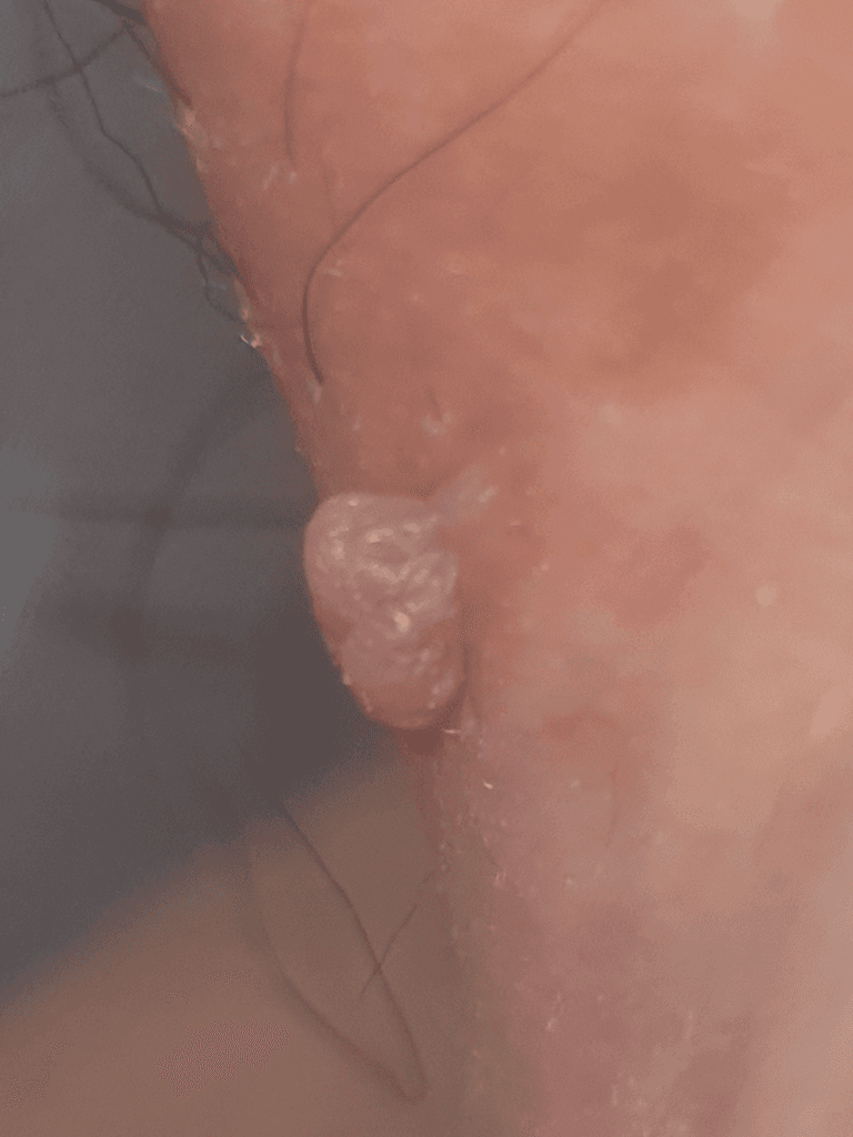2번 째 사진