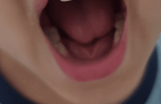 2번 째 사진