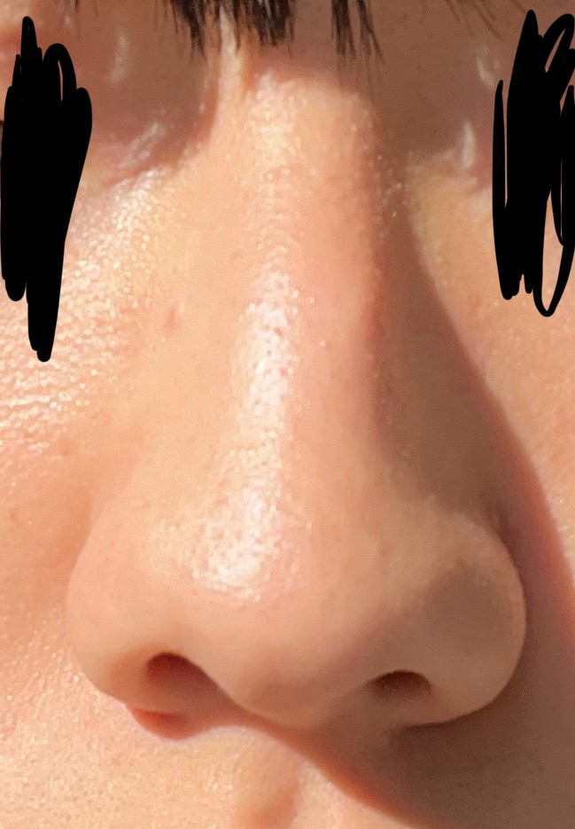 2번 째 사진