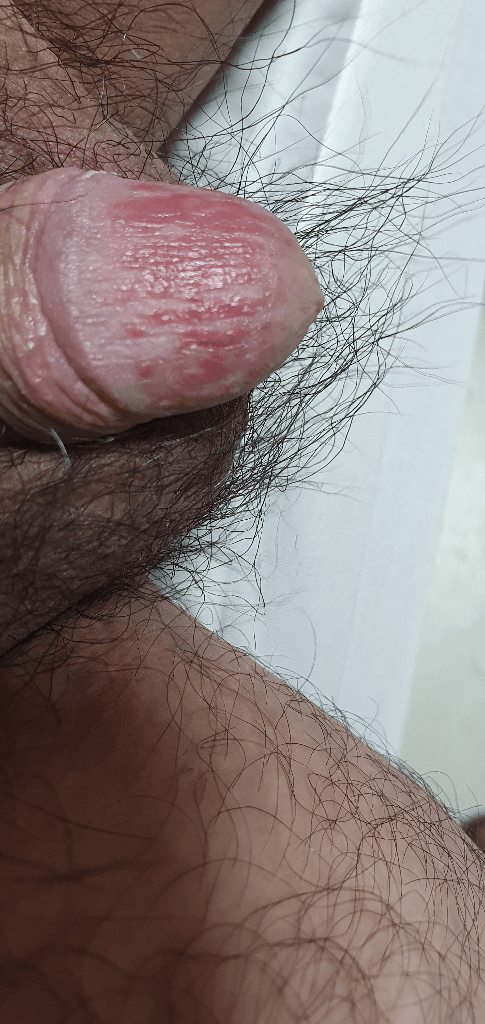 2번 째 사진