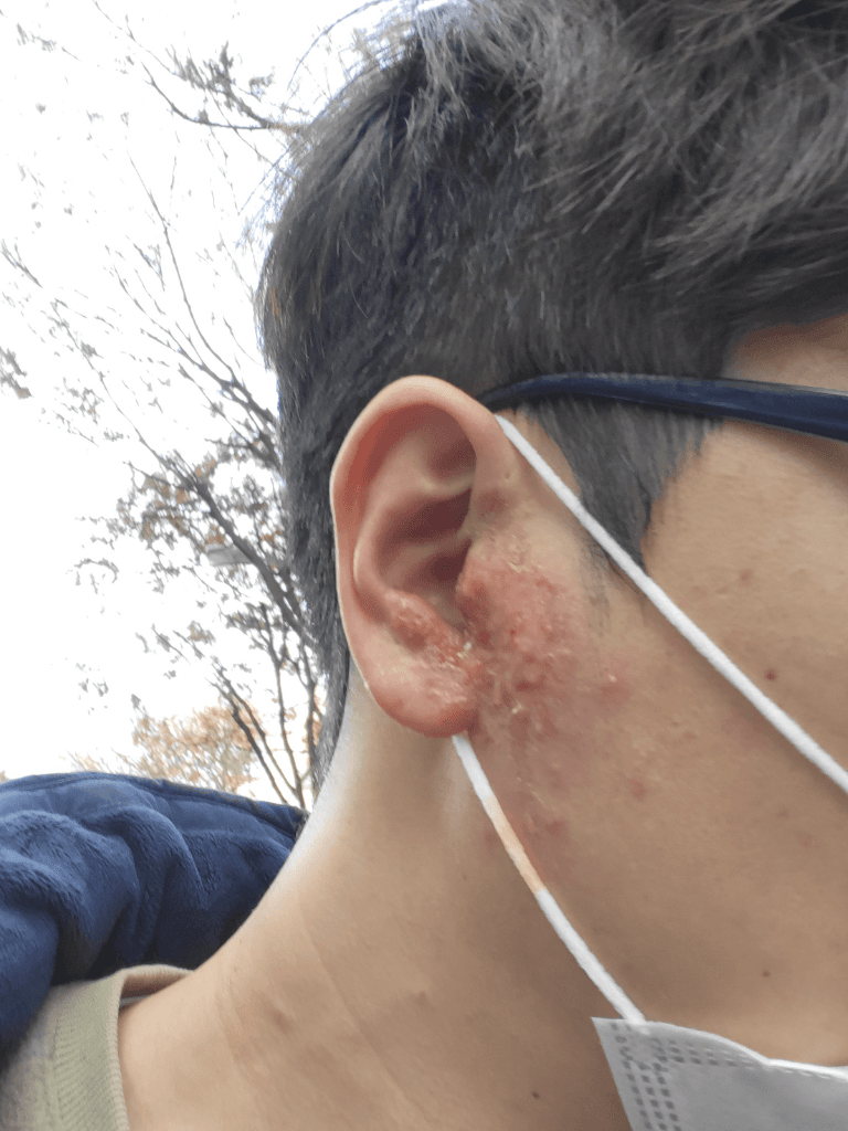 1번 째 사진