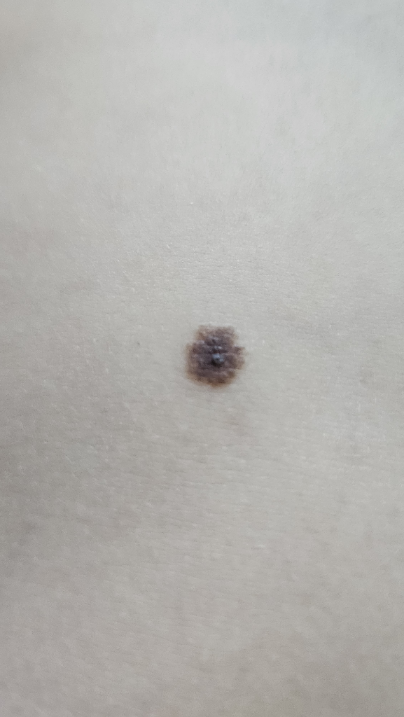 2번 째 사진