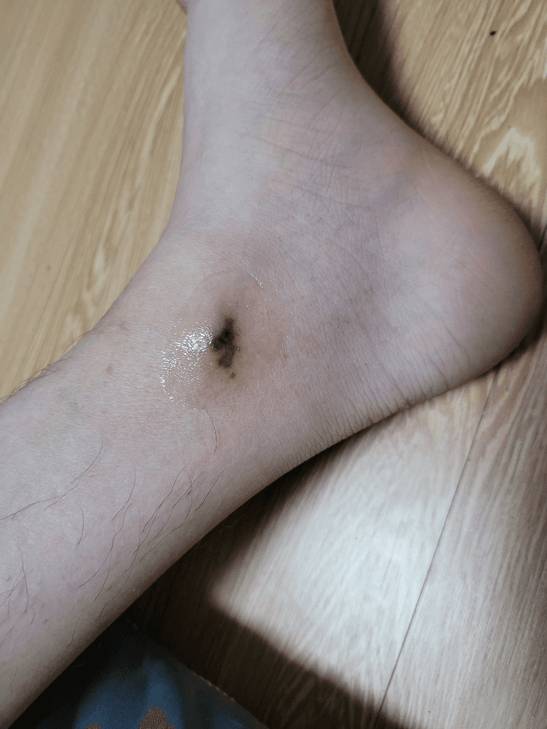 1번 째 사진