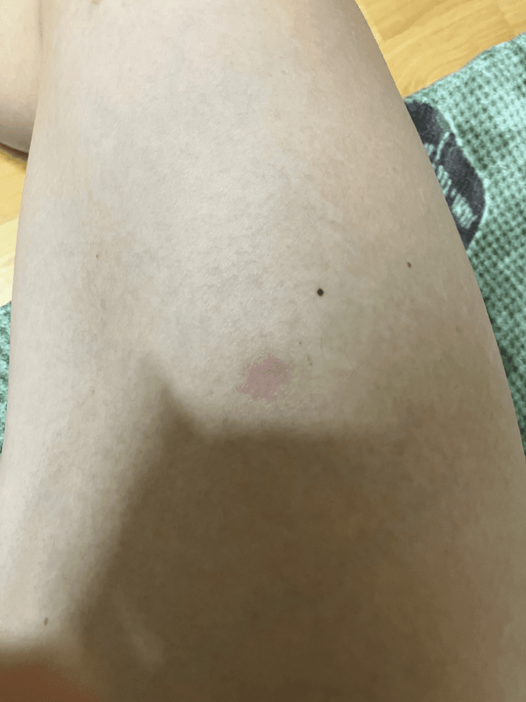 2번 째 사진