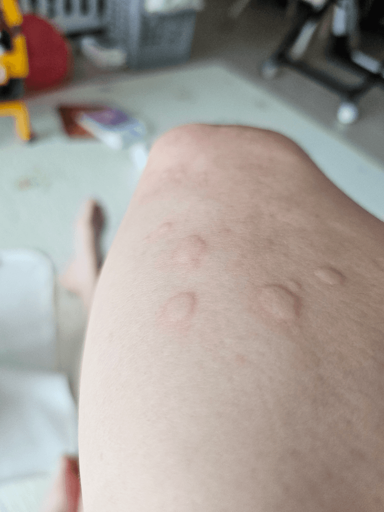2번 째 사진