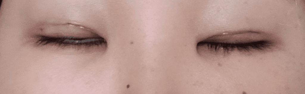 3번 째 사진