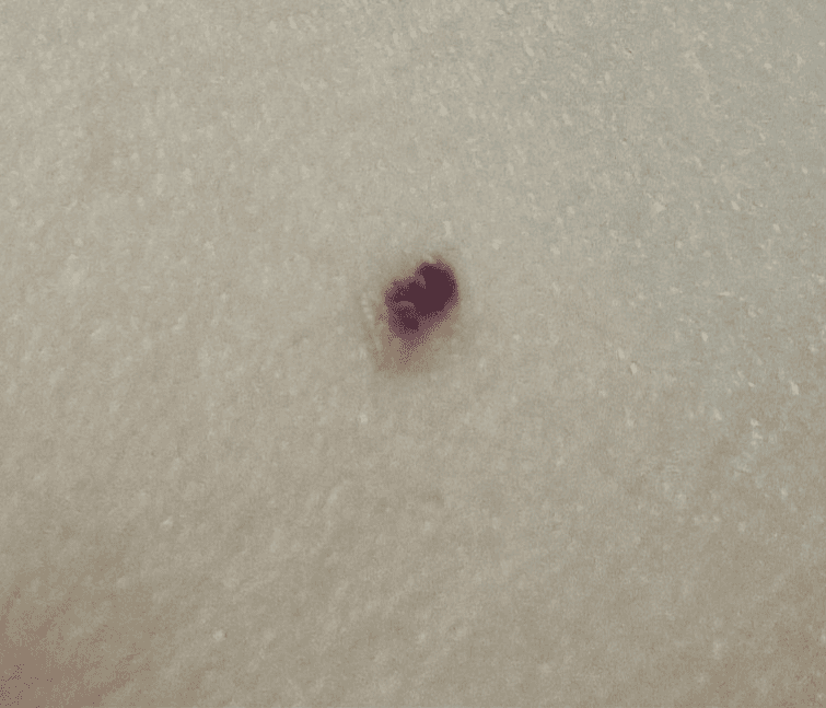 2번 째 사진