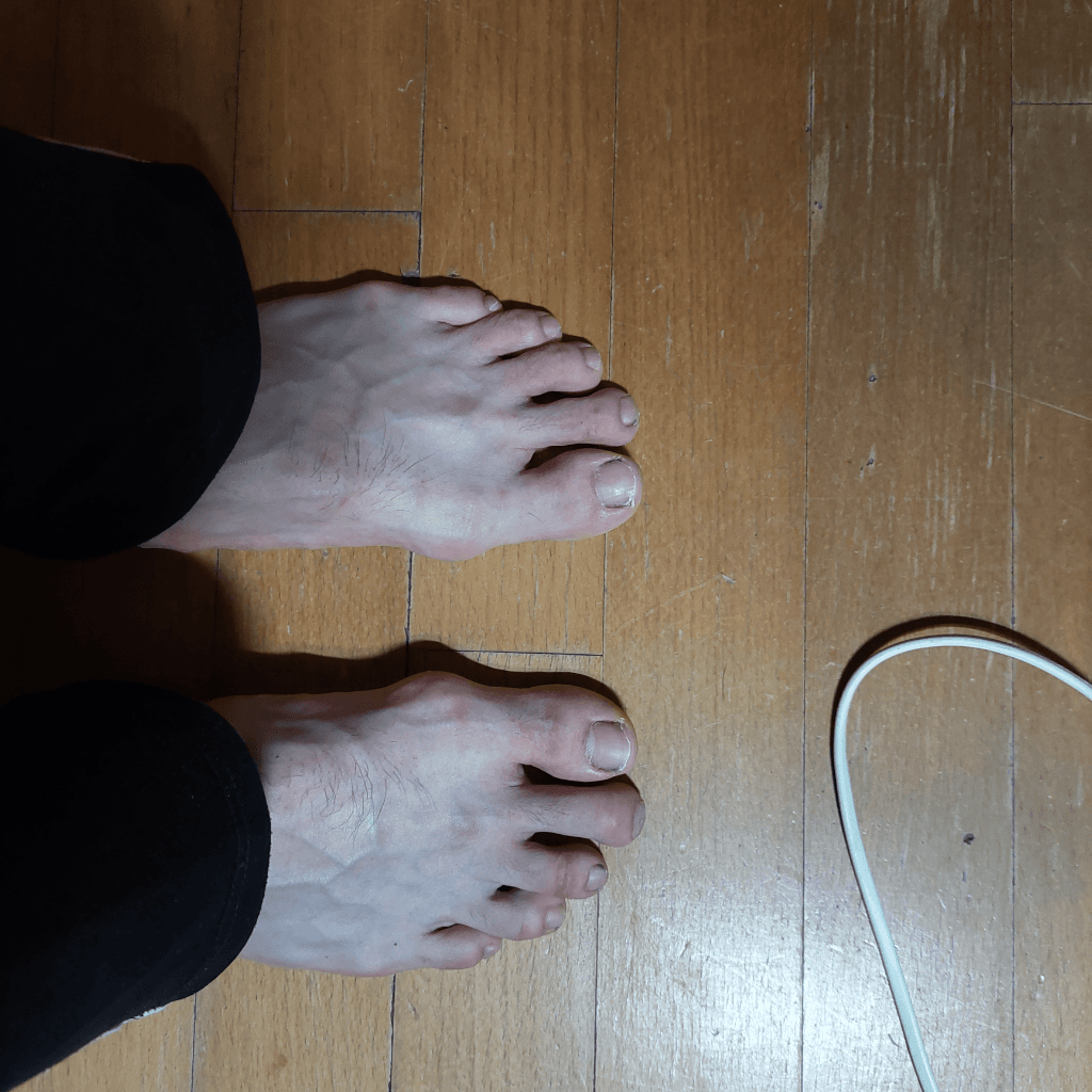 2번 째 사진
