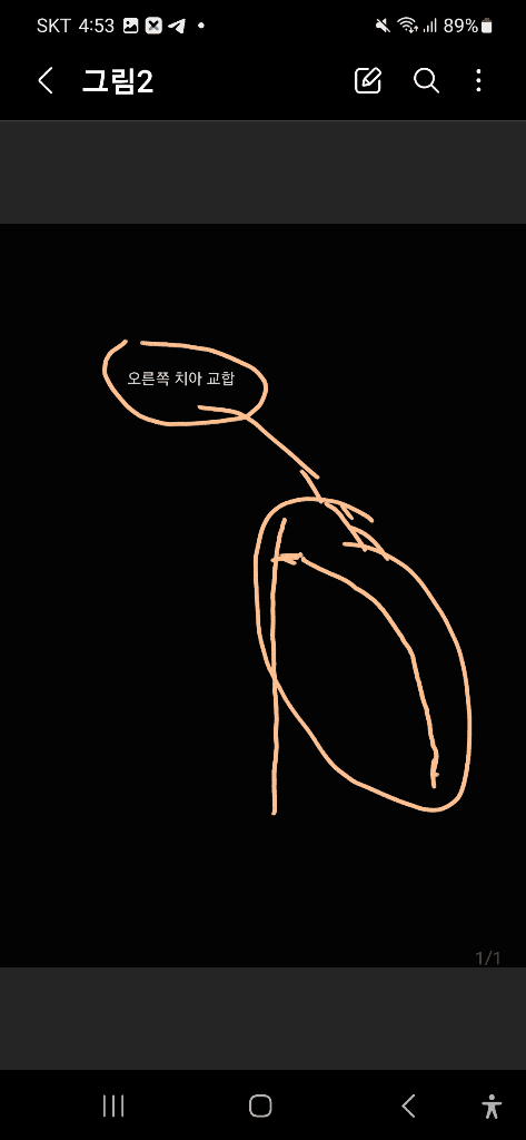 2번 째 사진