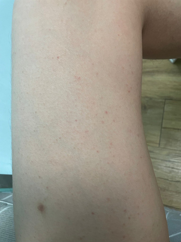 2번 째 사진