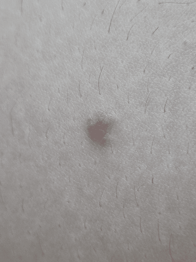 2번 째 사진