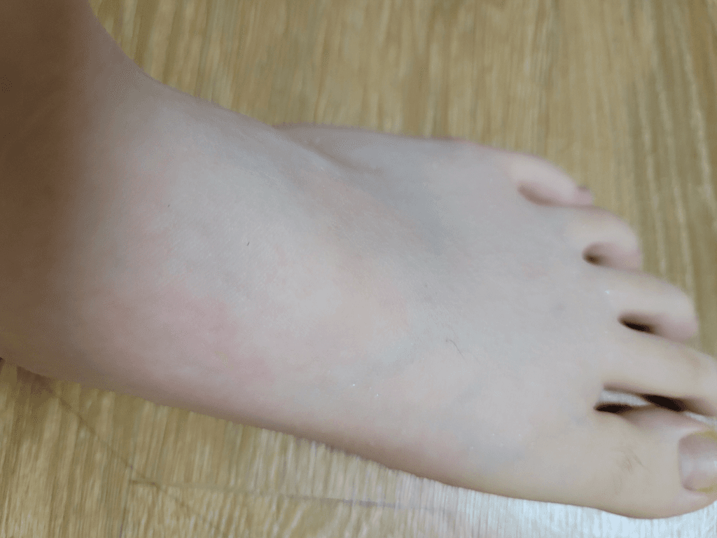 2번 째 사진