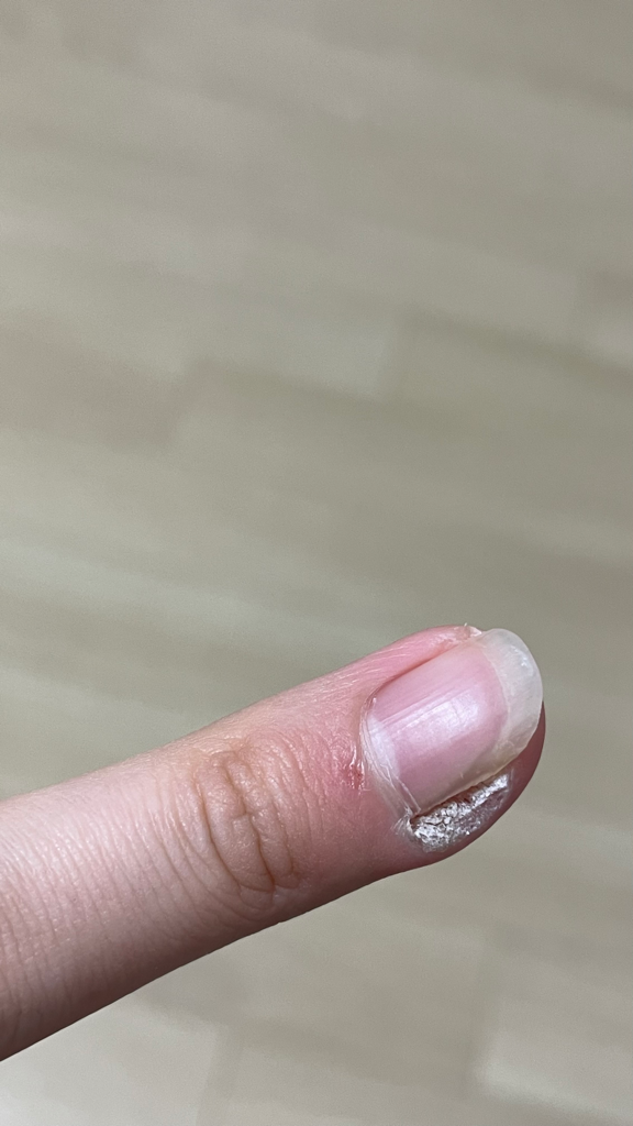 2번 째 사진