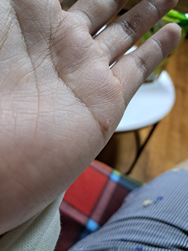 2번 째 사진