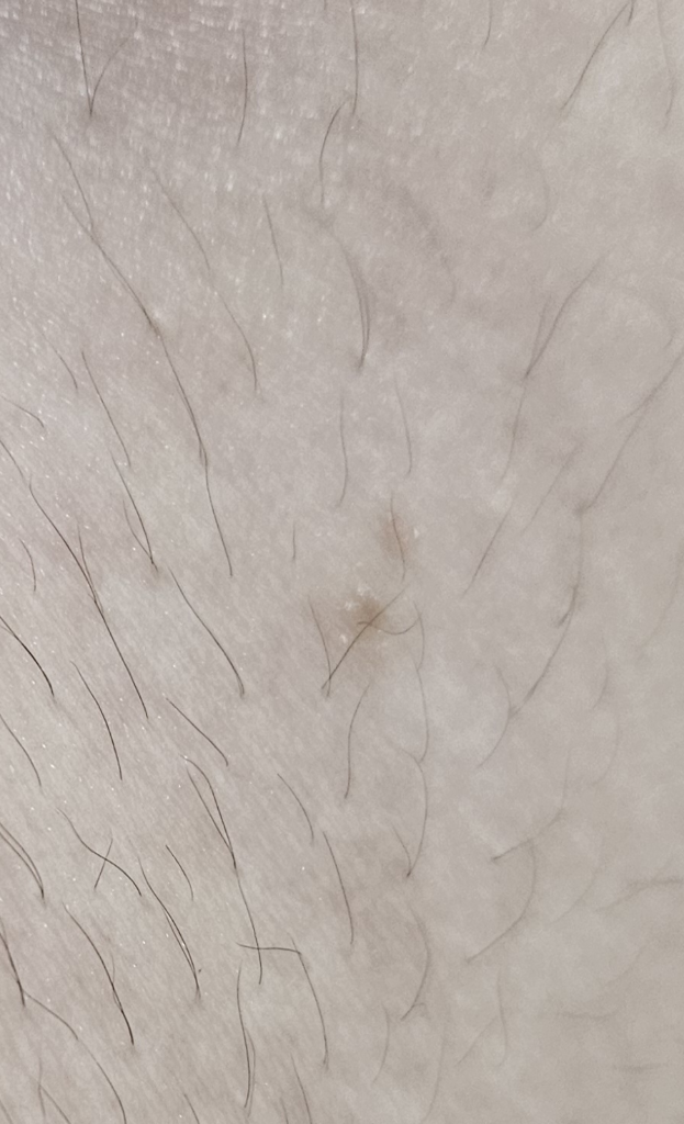2번 째 사진