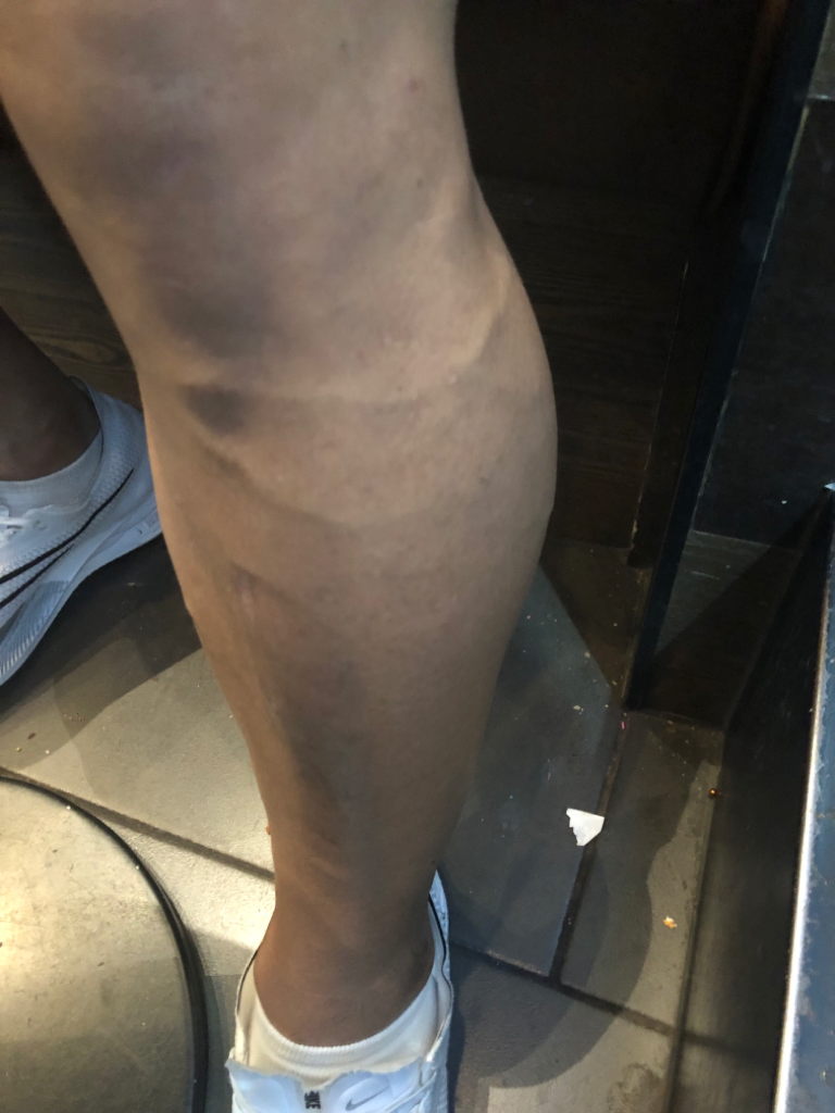 1번 째 사진