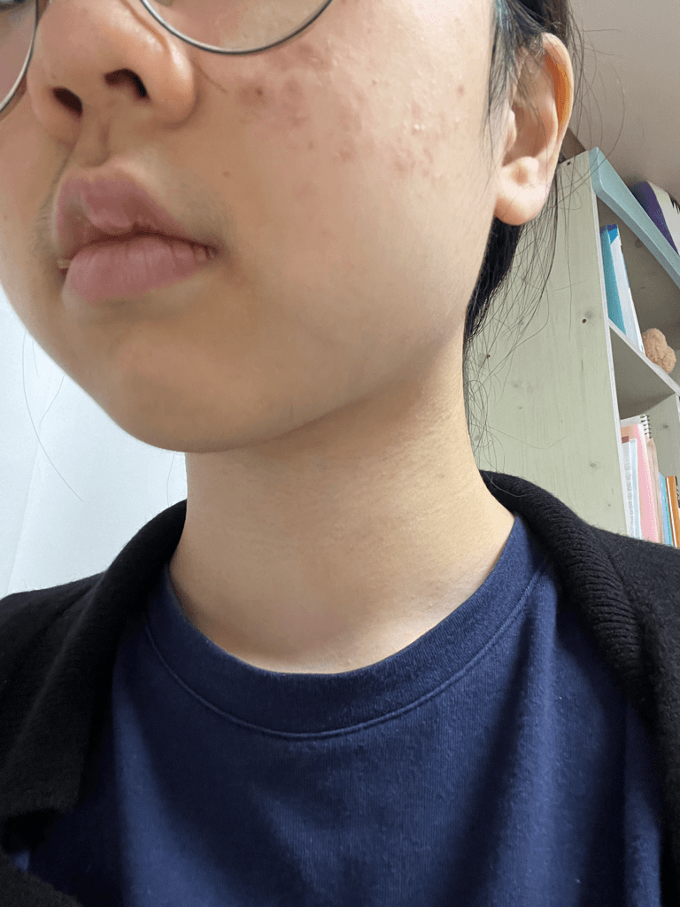 2번 째 사진