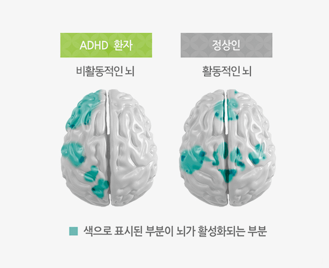 2번 째 사진