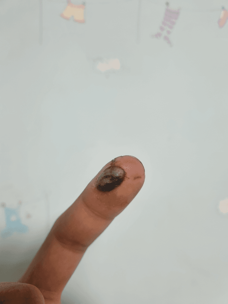 2번 째 사진