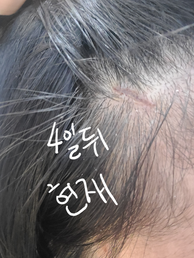 3번 째 사진