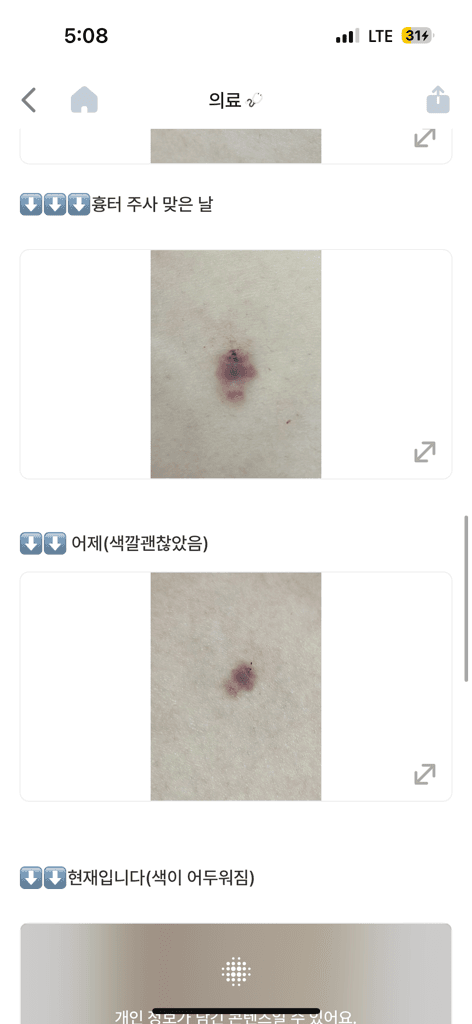 4번 째 사진