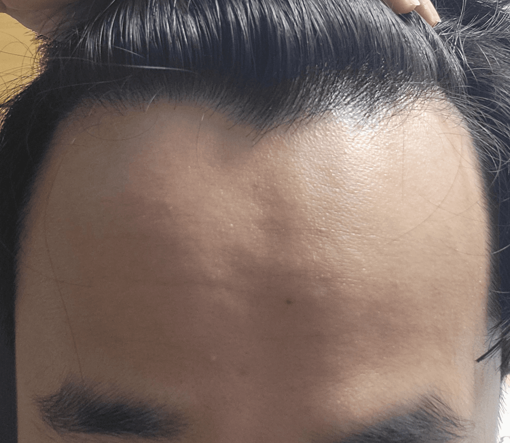 1번 째 사진
