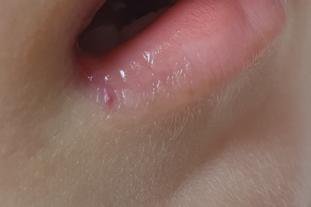 2번 째 사진