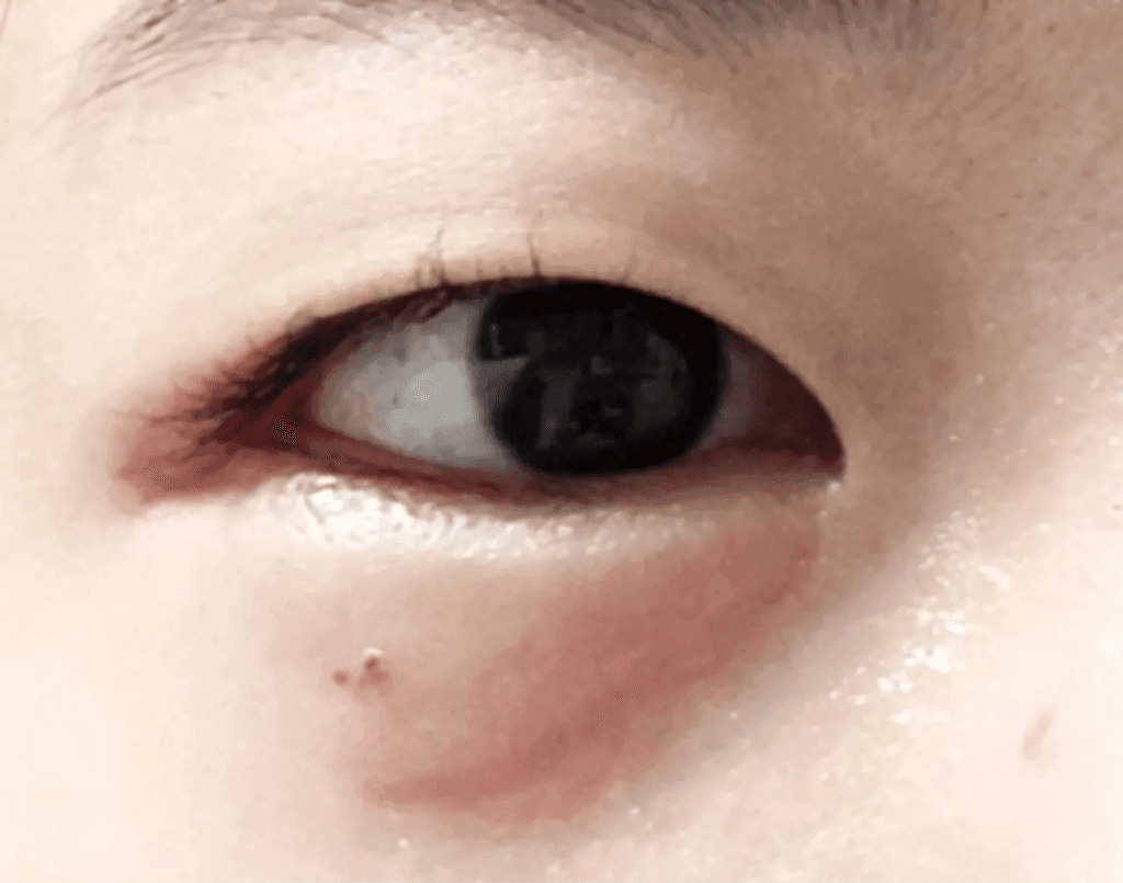 2번 째 사진