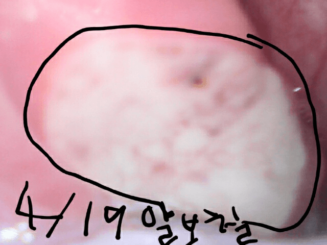 2번 째 사진