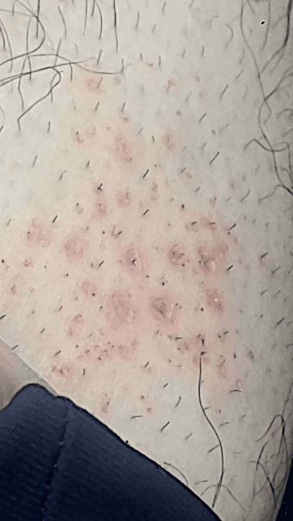 2번 째 사진