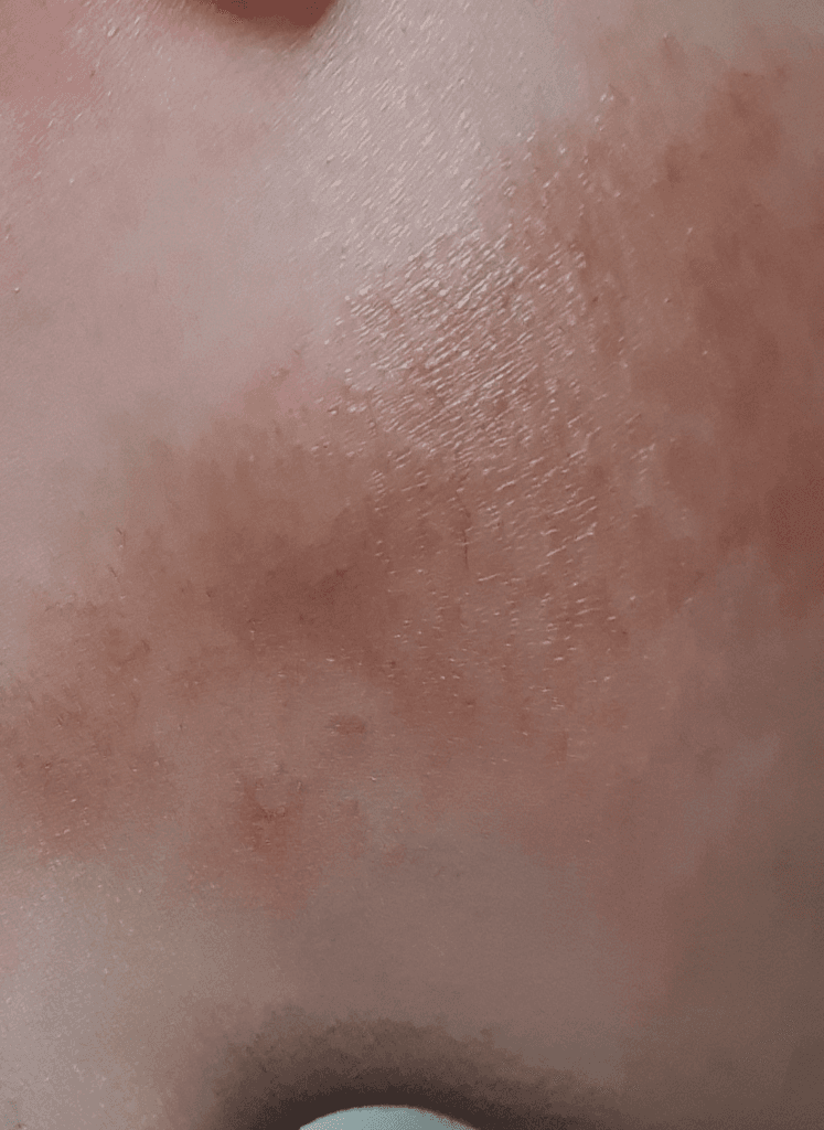 2번 째 사진
