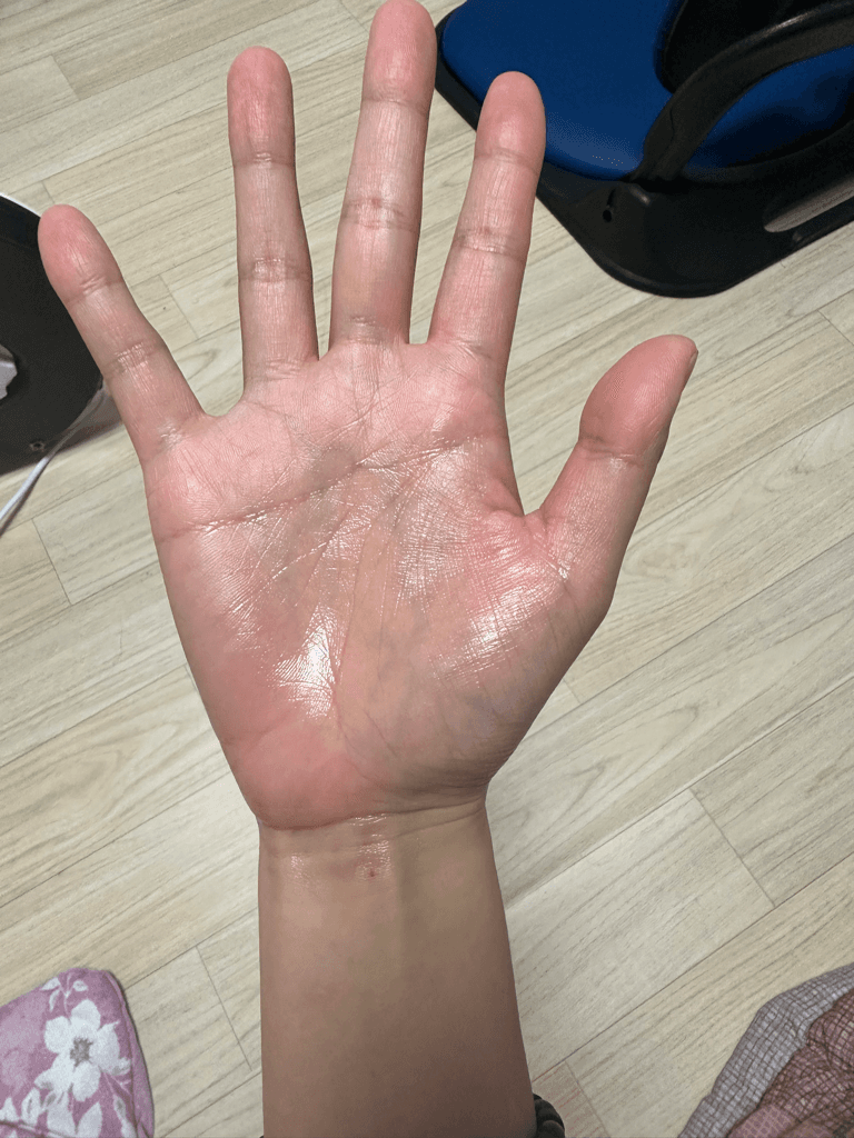 2번 째 사진