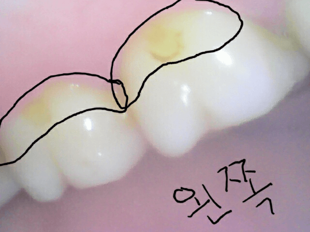 1번 째 사진