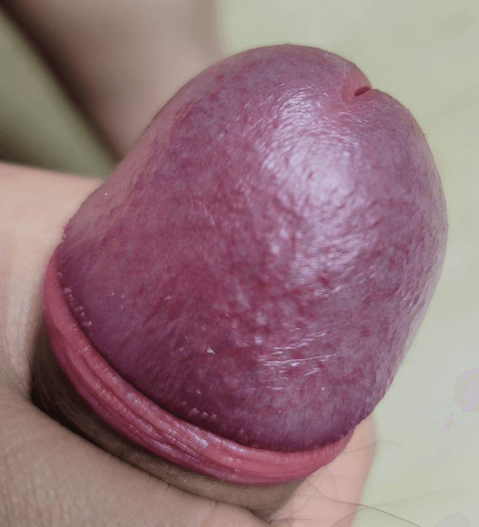 2번 째 사진