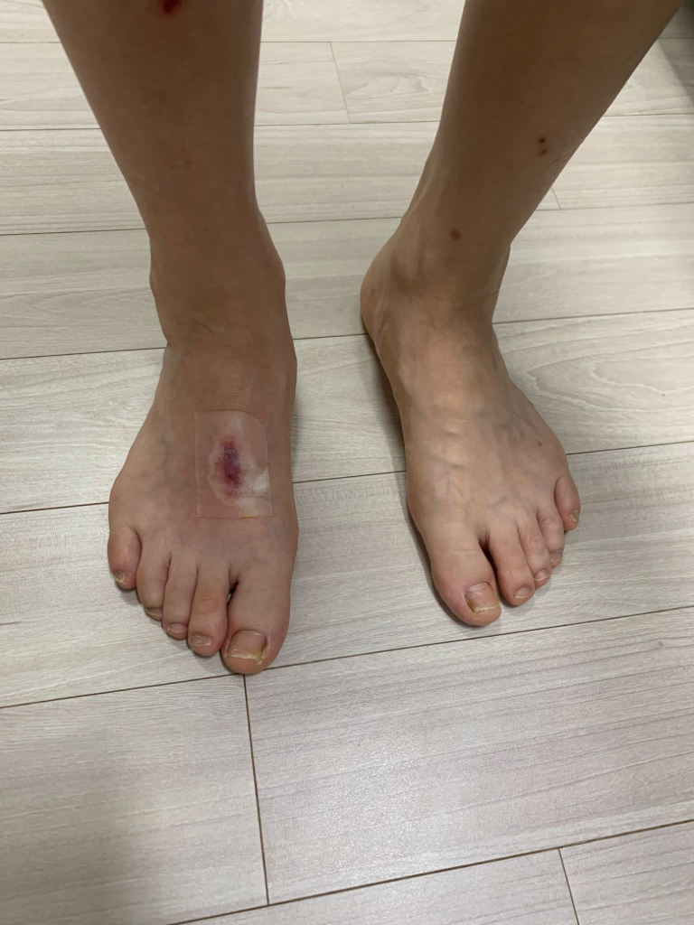 1번 째 사진
