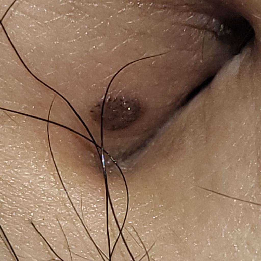 3번 째 사진