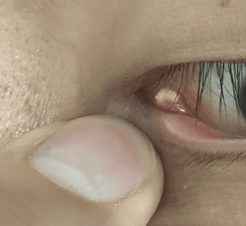 2번 째 사진
