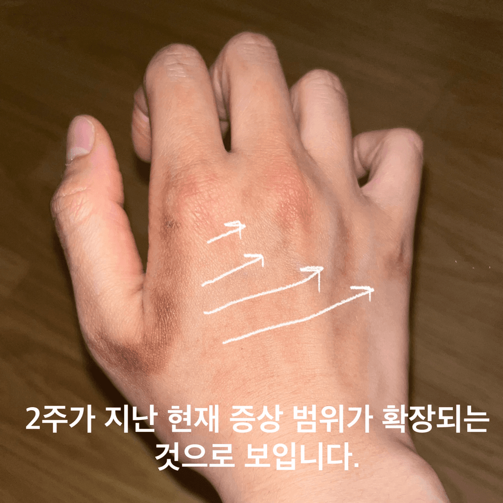 4번 째 사진