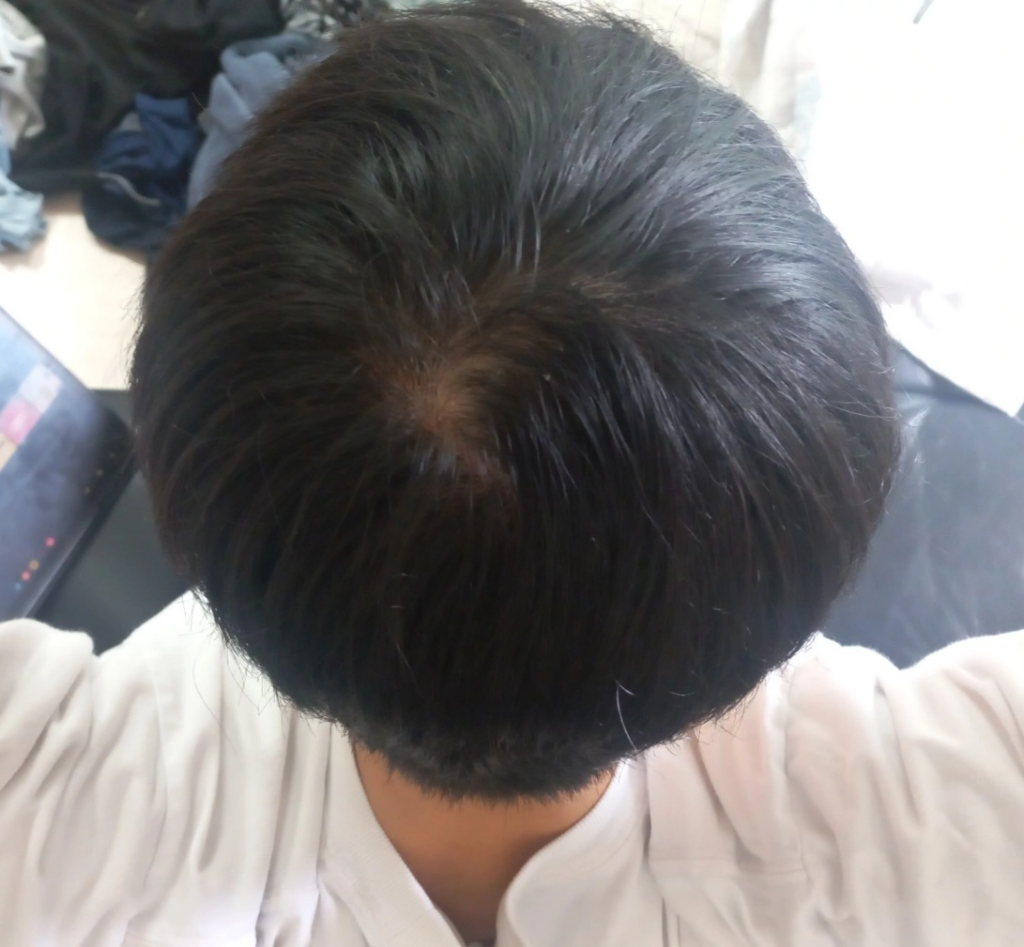1번 째 사진