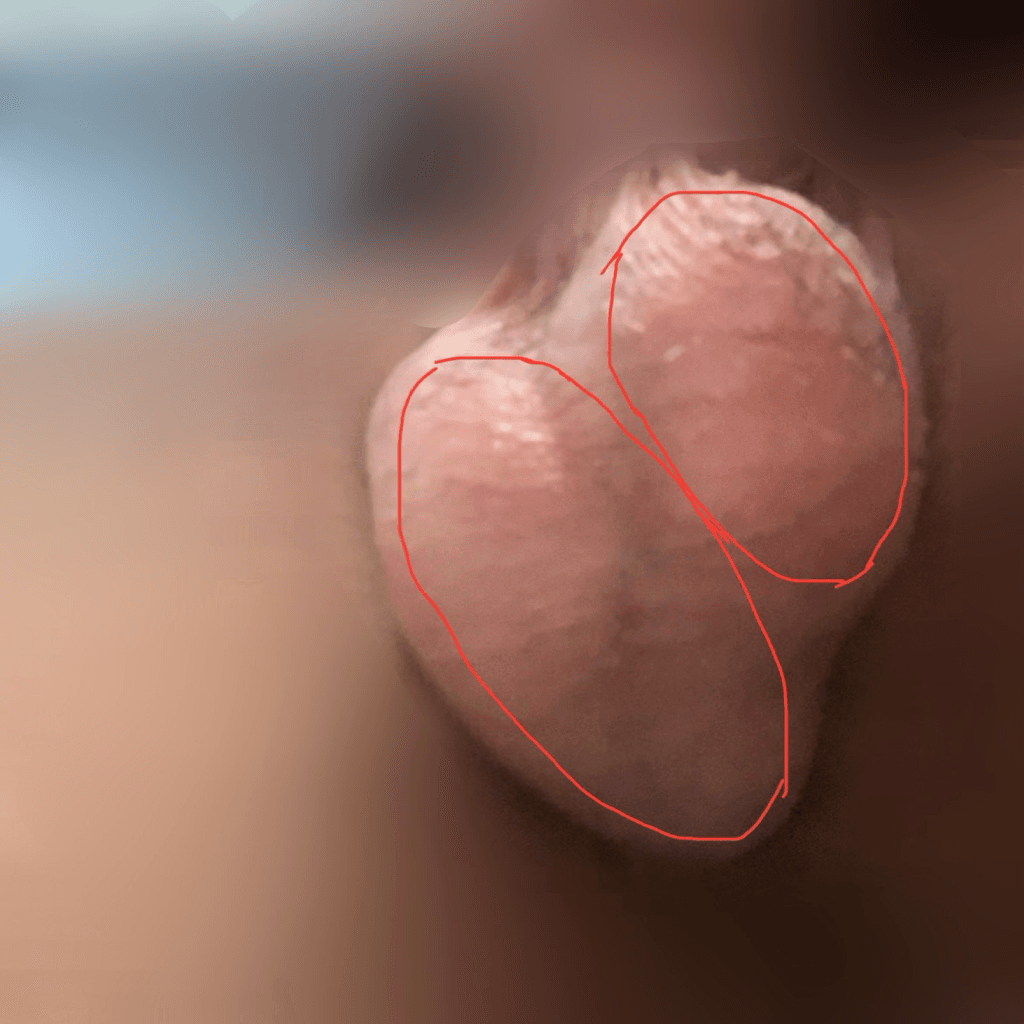 2번 째 사진