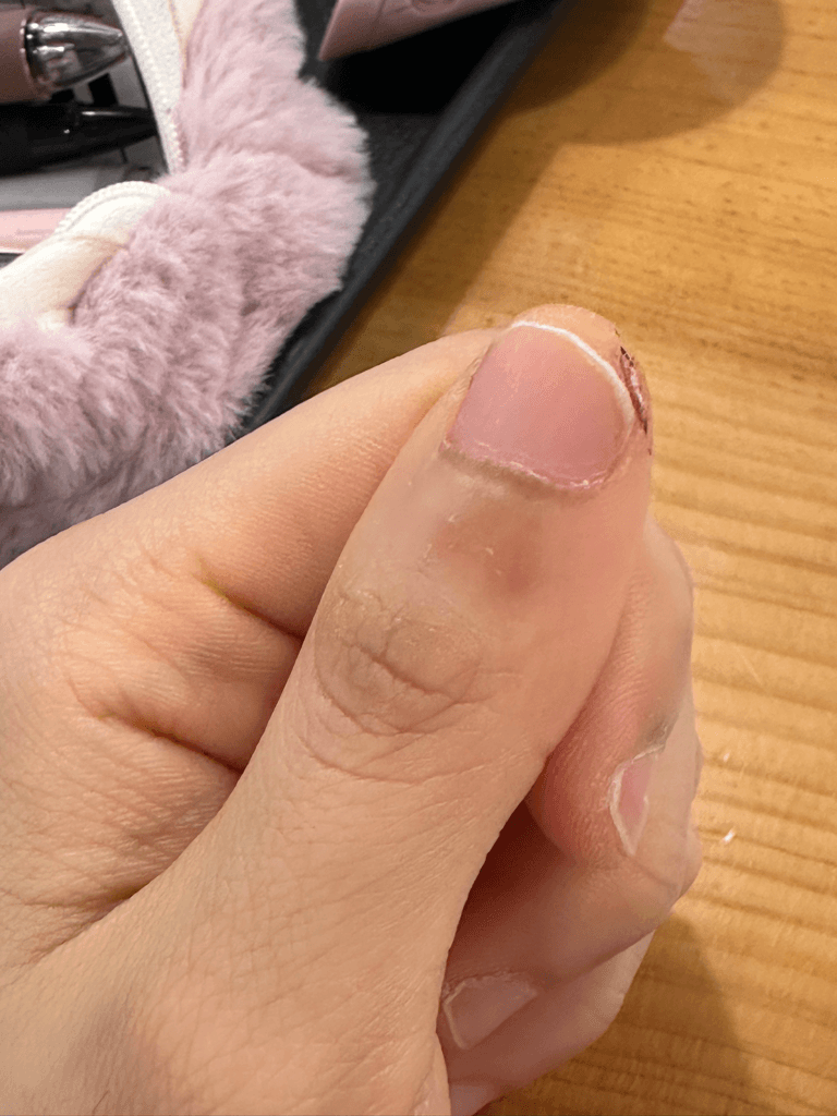 3번 째 사진