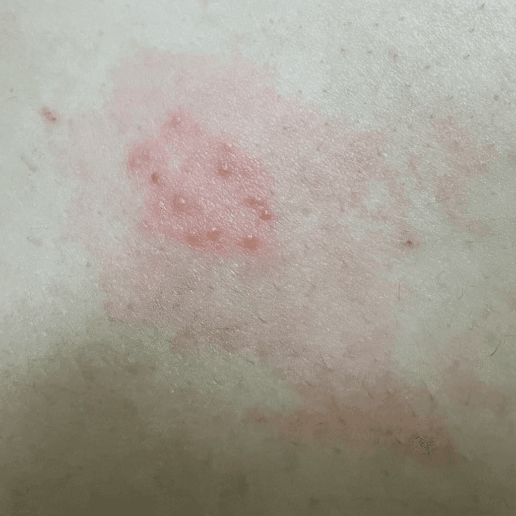2번 째 사진