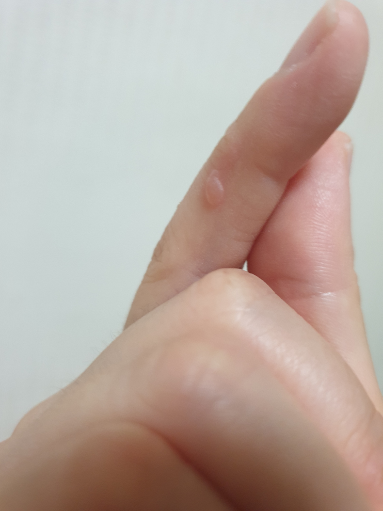 2번 째 사진